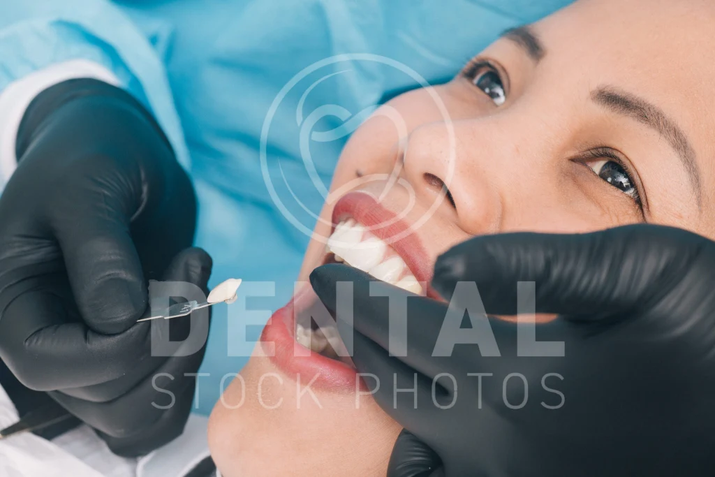 Dental Stock photo