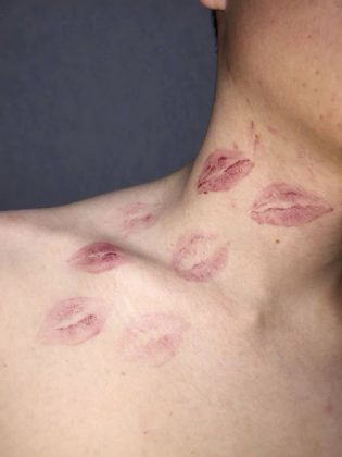 How to Give a Hickey: A Step-by-Step Guide to Passionate Marks