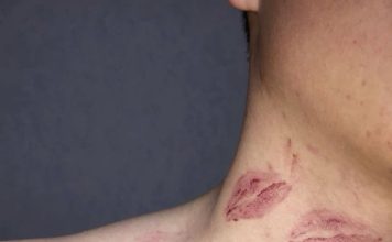 Cool Down with Kisses